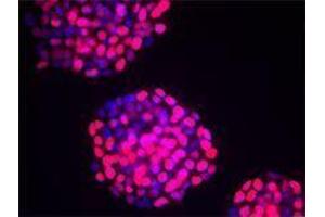 Immunofluorescence (IF) image for anti-Tumor Protein P53 (TP53) antibody (ABIN2664006) (p53 anticorps)