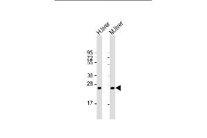 All lanes : Anti-HABP2 Antibody (C-term) at 1:2000 dilution Lane 1: human liver lysate Lane 2: mouse liver lysate Lysates/proteins at 20 μg per lane. (HABP2 anticorps  (C-Term))