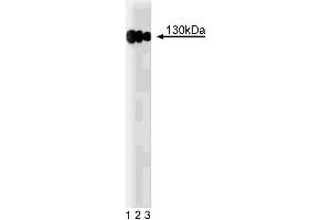 Western blot analysis of CD29 (Integrin beta1) on A431 lysate (Human epithelial carcinoma, ATCC CRL-1555). (ITGB1 anticorps  (AA 76-256))