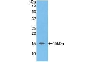Detection of Recombinant NKB, Human using Polyclonal Antibody to Neurokinin B (NKB) (Tachykinin 3 anticorps  (AA 23-121))
