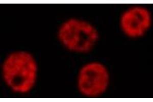ABIN6276851 staining HepG2? (LIG4 anticorps  (C-Term))