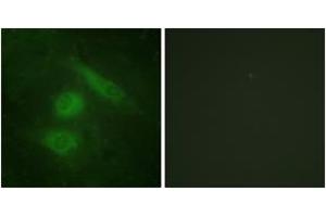 Immunofluorescence analysis of HeLa cells, using IRF3 (Ab-385) Antibody. (IRF3 anticorps  (AA 351-400))