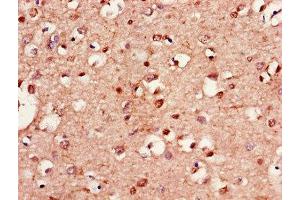 Immunohistochemistry of paraffin-embedded human brain tissue using ABIN7157902 at dilution of 1:100 (LANCL1 anticorps  (AA 50-150))