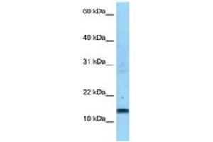 Image no. 1 for anti-Succinate Dehydrogenase Complex, Subunit C, Integral Membrane Protein, 15kDa (SDHC) (AA 59-108) antibody (ABIN6748189) (SDHC anticorps  (AA 59-108))