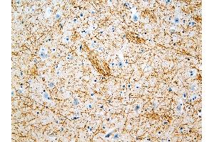anti-Neurofilament 70, 200kD antibody