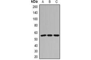 Western blot analysis of IFI44 expression in Hela (A), mouse kidney (B), rat kidney (C) whole cell lysates.