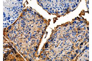 ABIN6261082 and ABIN6279333 at 1/100 staining Mouse testis tissue by IHC-P.