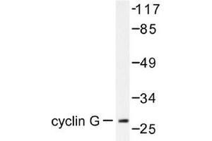 Image no. 1 for anti-Cyclin G1 (CCNG1) antibody (ABIN265382) (Cyclin G1 anticorps)