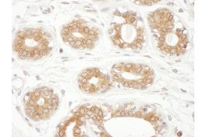 Immunohistochemistry (IHC) image for anti-Thioredoxin-Related Transmembrane Protein 1 (TMX1) (AA 230-280) antibody (ABIN7454574)