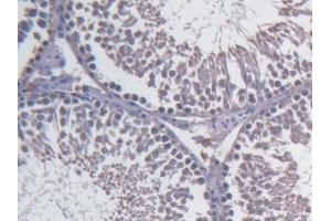 Detection of FBLN1 in Rat Testis Tissue using Monoclonal Antibody to Fibulin 1 (FBLN1) (Fibulin 1 anticorps)