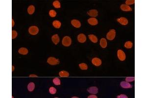 Immunofluorescence analysis of C6 cells using TADA3 Polyclonal Antibody at dilution of 1:100. (TADA3L anticorps)