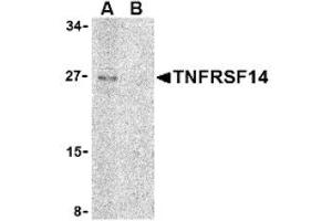 Image no. 1 for anti-Tumor Necrosis Factor Receptor Superfamily, Member 14 (TNFRSF14) (C-Term) antibody (ABIN265159) (HVEM anticorps  (C-Term))