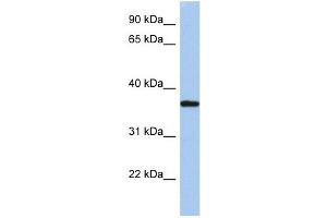 LDLRAP1 antibody used at 1 ug/ml to detect target protein.