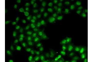Immunofluorescence analysis of U2OS cells using C11orf30 antibody (ABIN6127846, ABIN6137723, ABIN6137725 and ABIN6221740). (EMSY anticorps  (AA 1153-1322))