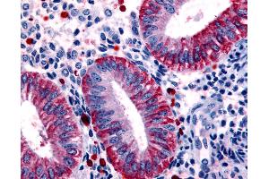 Anti-DKK1 antibody IHC of human uterus, endometrium.