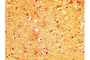 IHC image of ABIN7174953 diluted at 1:300 and staining in paraffin-embedded human brain tissue performed on a Leica BondTM system.