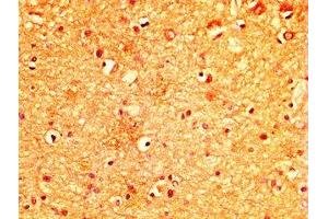 IHC image of ABIN7174953 diluted at 1:300 and staining in paraffin-embedded human brain tissue performed on a Leica BondTM system. (MYO5A anticorps  (AA 1087-1220))