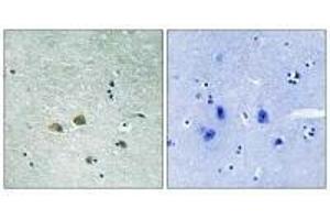 Immunohistochemistry analysis of paraffin-embedded human brain tissue using PAK1 (Ab-204) antibody.