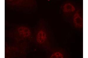 Immunofluorescence staining of methanol-fixed Hela cells using Myc(Phospho-Ser62) Antibody. (c-MYC anticorps  (pSer62))