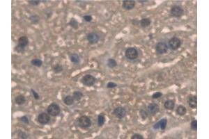 Detection of PNPO in Mouse Liver Tissue using Polyclonal Antibody to Pyridoxamine-5'-Phosphate Oxidase (PNPO)