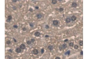 Detection of PNPO in Mouse Liver Tissue using Polyclonal Antibody to Pyridoxamine-5'-Phosphate Oxidase (PNPO) (PNPO anticorps  (AA 1-261))
