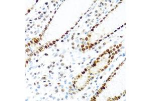 Immunohistochemistry of paraffin-embedded human stomach using KHDRBS2 antibody (ABIN5975782) at dilution of 1/100 (40x lens). (KHDRBS2 anticorps)
