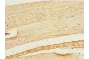 Immunohistochemistry of paraffin-embedded human skeletal muscle tissue using ABIN7152072 at dilution of 1:100