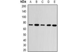 Western blot analysis of GMPS expression in MCF7 (A), SKOV3 (B), mouse kidney (C), mouse brain (D), rat heart (E) whole cell lysates.