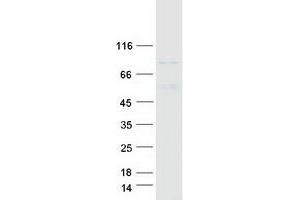 Validation with Western Blot
