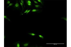 Immunofluorescence of purified MaxPab antibody to DNAJB4 on HeLa cell. (DNAJB4 anticorps  (AA 1-337))