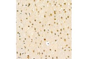 Immunohistochemistry of paraffin embedded rat brain using HOXC9 (ABIN7074251) at dilution of 1:700 (400x lens)