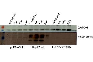Western Blot of Rabbit anti-p27kip1pS140 antibody. (CDKN1B anticorps  (Internal Region, pSer140))