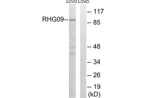 Western blot analysis of extracts from LOVO cells, using RHG9 antibody. (ARHGAP9 anticorps  (Internal Region))