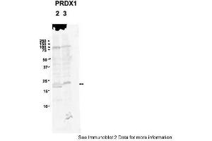 Sample Type: 2. (Peroxiredoxin 1 anticorps  (N-Term))