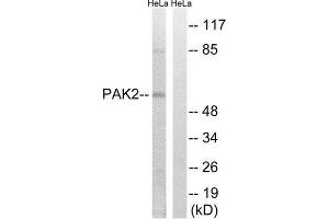 Western Blotting (WB) image for anti-P21-Activated Kinase 2 (PAK2) (Ser141) antibody (ABIN1848251) (PAK2 anticorps  (Ser141))