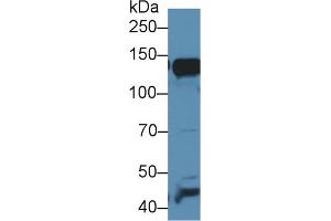 Western blot analysis of Mouse Liver lysate, using Mouse AAP Antibody (1 µg/ml) and HRP-conjugated Goat Anti-Rabbit antibody ( (ALT anticorps  (AA 720-961))
