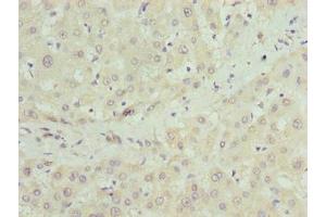 Immunohistochemistry of paraffin-embedded human liver tissue using ABIN7149063 at dilution of 1:100 (CRISPLD1 anticorps  (AA 24-300))