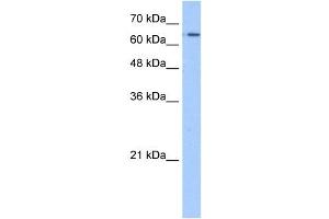 SLC22A11 antibody used at 1. (SLC22A11 anticorps)