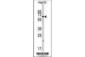 Western blot analysis of anti-SWAP70 Antibody in HepG2 cell line lysates (35ug/lane).