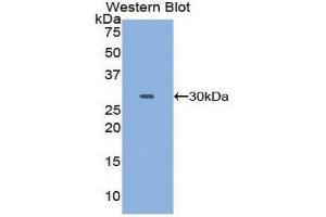 Western Blotting (WB) image for anti-DNA Topoisomerase II (TOP2) (AA 923-1148) antibody (ABIN1860829) (TOP2 anticorps  (AA 923-1148))
