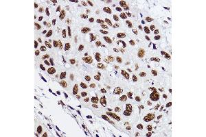 Immunohistochemistry of paraffin-embedded human esophageal using GTF2F2 Rabbit mAb (ABIN7267373) at dilution of 1:100 (40x lens). (GTF2F2 anticorps)