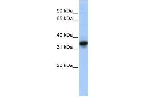 MUC3B antibody used at 1 ug/ml to detect target protein. (MUC3B anticorps  (N-Term))