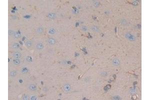 Detection of MAP4 in Rat Brain Tissue using Polyclonal Antibody to Microtubule Associated Protein 4 (MAP4)