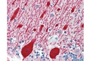 Immunohistochemical analysis of paraffin-embedded human brain cerebellum using AMACR mouse mAb.