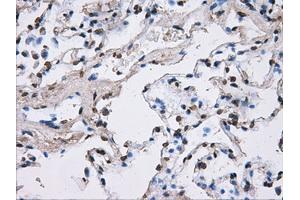 Image no. 14 for anti-ATP Synthase, H+ Transporting, Mitochondrial F1 Complex, beta Polypeptide (ATP5B) antibody (ABIN1496766)