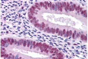 Human Uterus: Formalin-Fixed, Paraffin-Embedded (FFPE)
