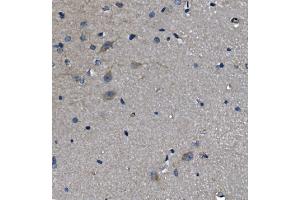 IHC analysis of ADRA1A using anti-ADRA1A antibody (ABIN3043732). (alpha 1 Adrenergic Receptor anticorps  (C-Term))