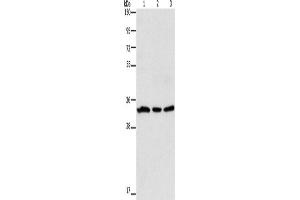 Western Blotting (WB) image for anti-Glycoprotein A33 (Transmembrane) (GPA33) antibody (ABIN2428183) (GPA33 anticorps)
