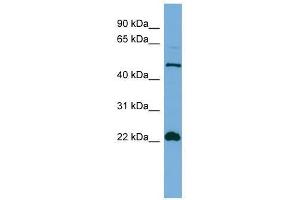 HEMGN antibody used at 0. (HEMGN anticorps  (N-Term))