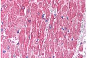 Human Heart (formalin-fixed, paraffin-embedded) stained with CLIC5 antibody ABIN214746 at 2. (CLIC5 anticorps  (C-Term))